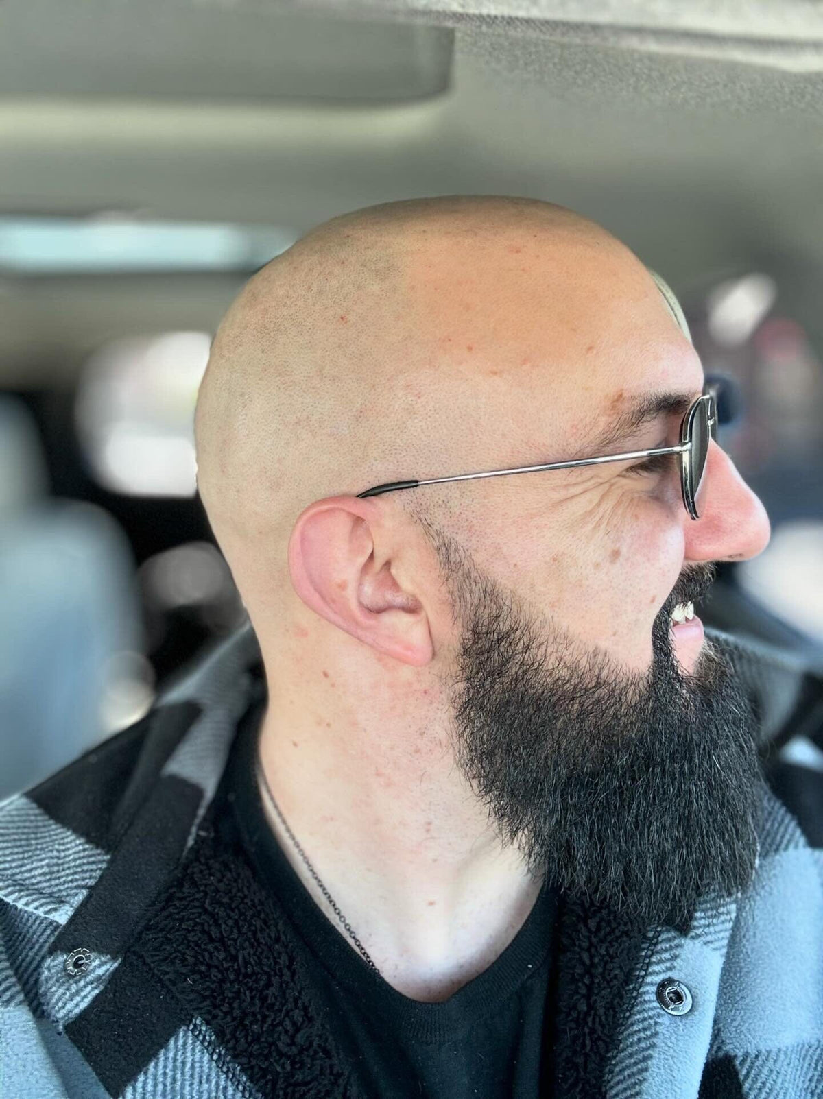 The Complete Bald Head Care System